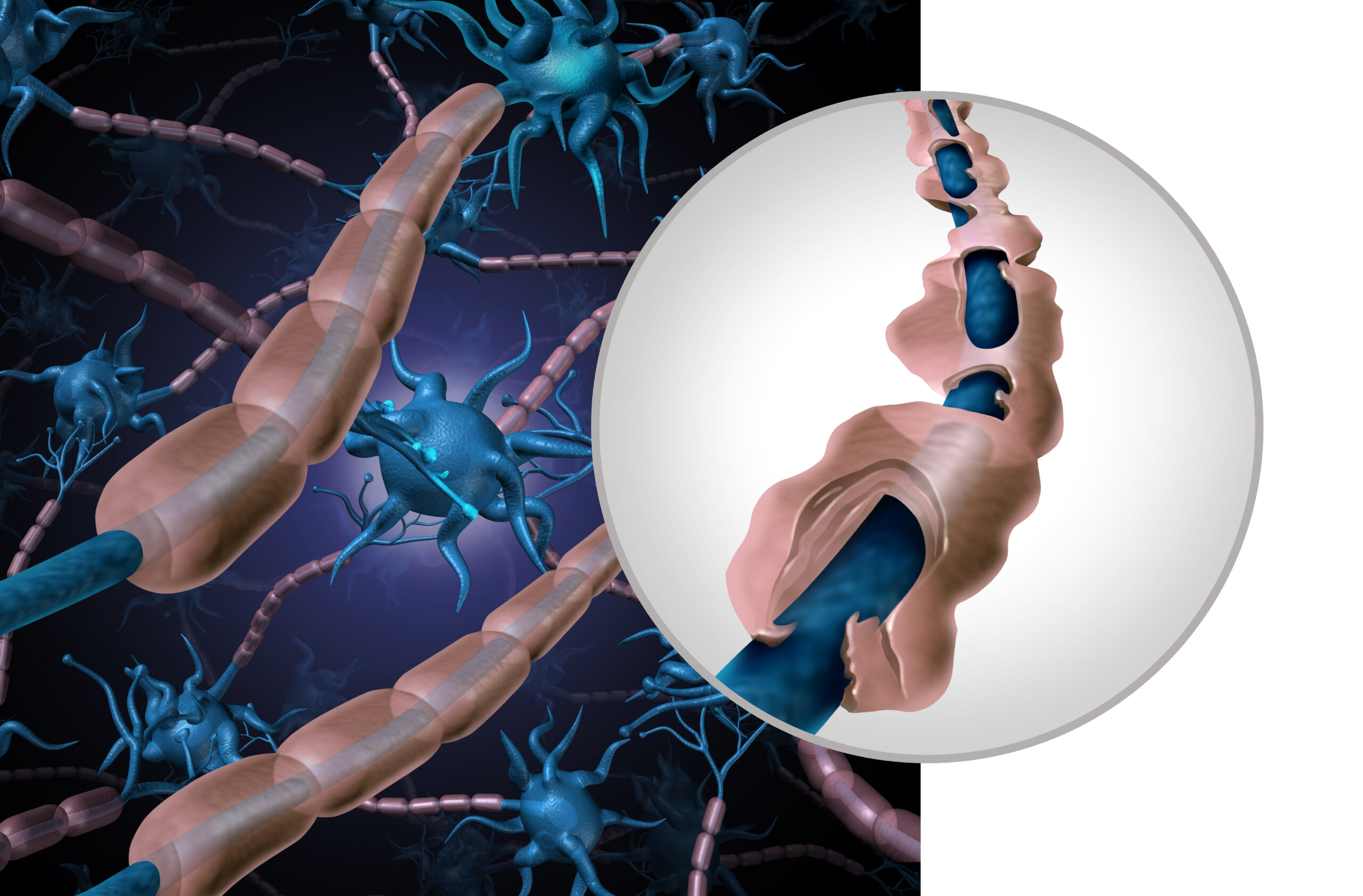 Estudio descubre un método prometedor para tratar la Esclerosis Múltiple: teofilina y remielinización