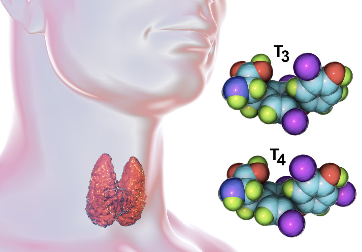 Compuesto que imita a la hormona tiroidea previene daño de la Esclerosis Múltiple en los nervios en ratones