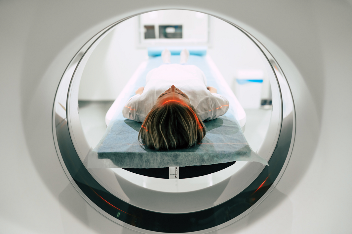 Una nueva técnica de resonancia magnética podría acelerar el diagnóstico de Esclerosis Múltiple