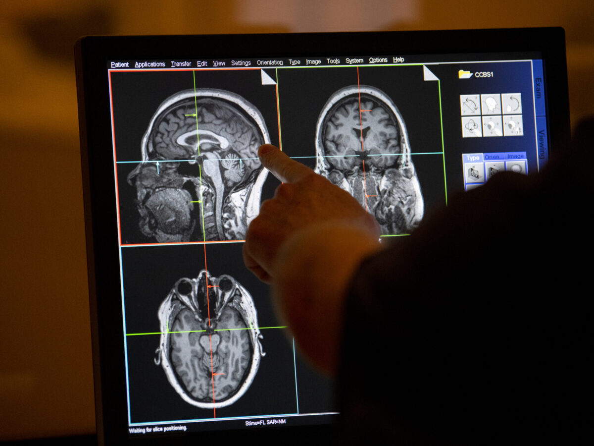 Comienza un gran estudio cerebral para prevenir enfermedades neurológicas como la Esclerosis Múltiple