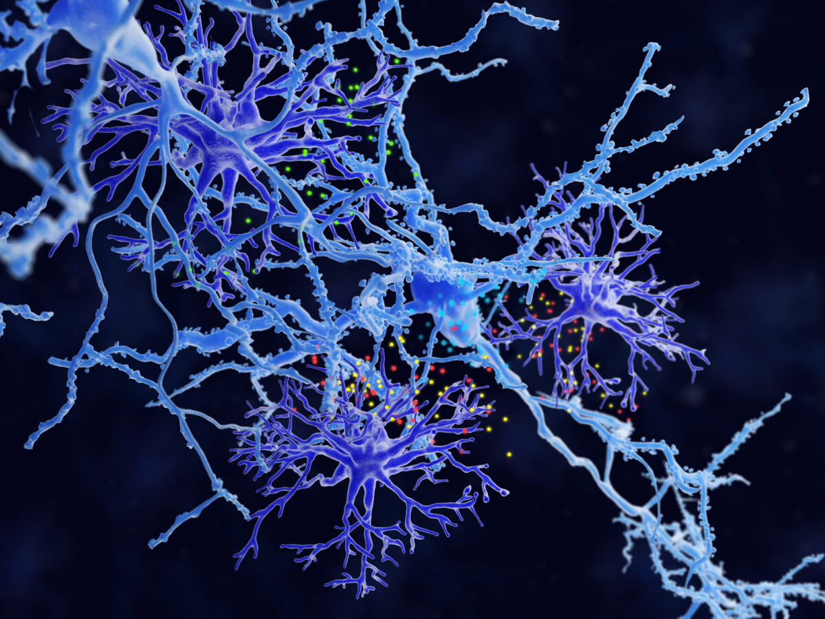 Un estudio de Vall d'Hebron identifica uno de los mecanismos que provoca daños neuronales en Esclerosis Múltiple