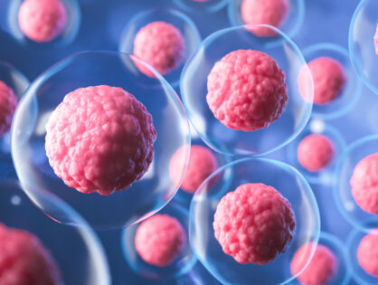 Terapia con células madre para Esclerosis Múltiple, ¿qué sabemos hasta ahora?