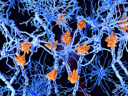 Una nueva investigación revela el poder de la microglía en la Esclerosis Múltiple
